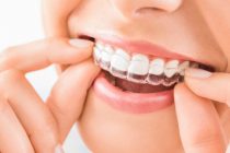 A Lasting Smile: Exploring The World Of Dental Implants